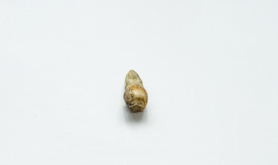 安图县石门镇石门山一个石灰岩洞穴内发掘出土一枚人类牙齿化石