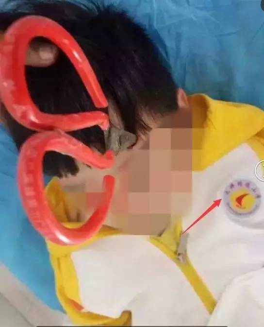 可怕赣州一小男孩脑门被扎一把剪刀原因竟是