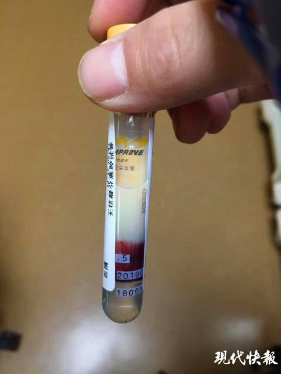 中年男突然肚子疼 医生抽出一管"牛奶血"