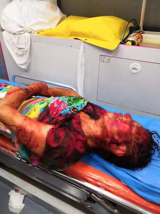 拾荒老人凌晨遭4条恶狗撕咬浑身是血 狗主人未露面