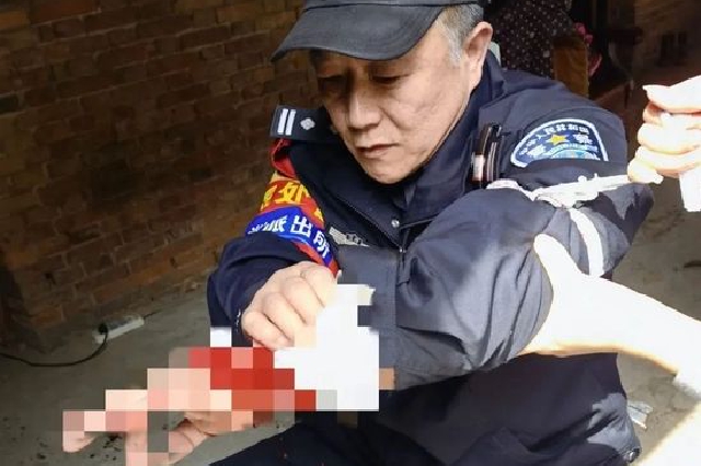 江西民警手臂挡刀救下男子生命 自己的手臂却被刺穿