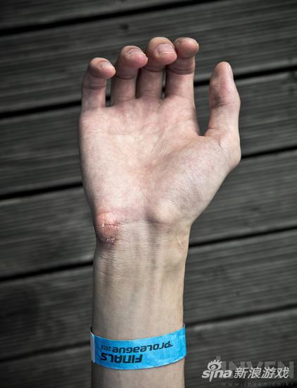 一分耕耘一分收获星际争霸新晋冠军byun晒手茧