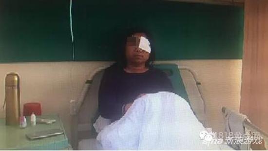 400元新买手机胸前爆炸起火 倒霉女子遭烧伤住院