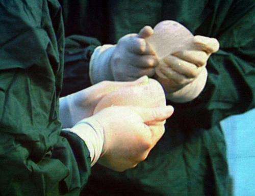 72岁老汉做变性手术:以后可和妻子姐妹相称