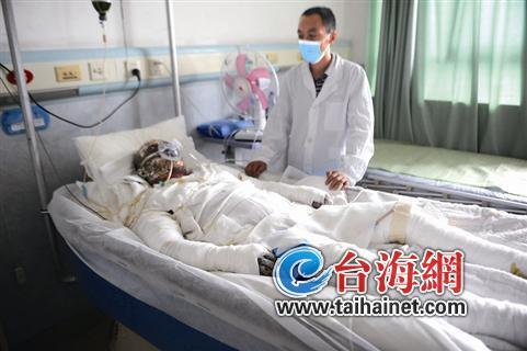 漳一男子洗澡时液化气爆燃全身90烧伤缠满绷带