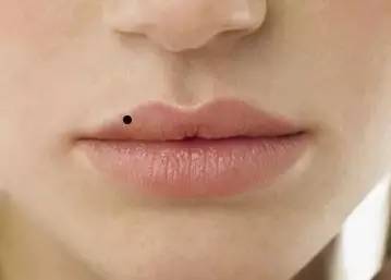 嘴唇上长痣代表什么图片