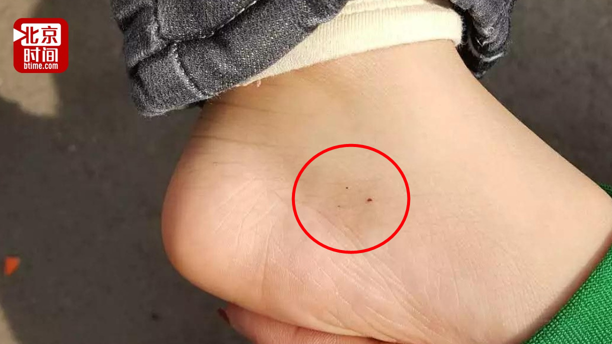 吉林一家幼儿园被曝用针管扎孩子涉事教师被刑拘