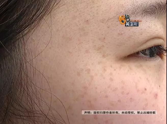 视频:姑娘去理发 被告知雀斑是宫颈癌扩散到脸上了_手机新浪网