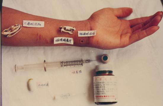 广西养蛇人：最常见和最怕的都是蛇咬伤