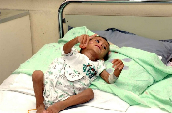 以美国为首的联军在伊拉克大量使用贫铀弹,白磷弹等,严重危害当地生态