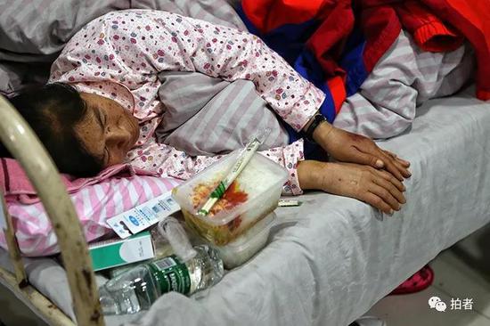 手动病床怎么装视频响水爆炸伤者谈赔偿问题：小命保住就不错了_https://www.jmylbn.com_新闻资讯_第11张