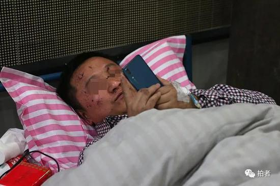 手动病床怎么装视频响水爆炸伤者谈赔偿问题：小命保住就不错了_https://www.jmylbn.com_新闻资讯_第7张