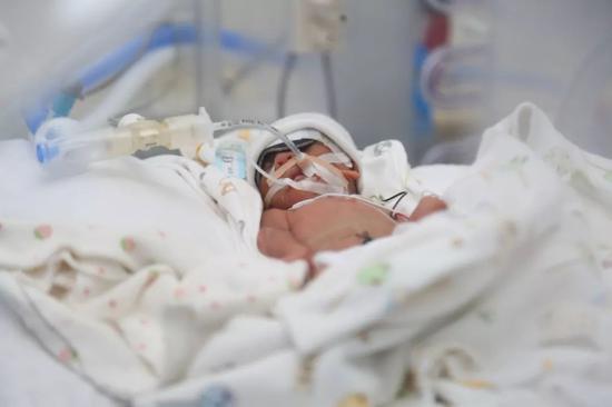 24周龙凤胎早产弟弟夭折 720克姐姐只有巴掌大|新生儿科|宝宝_新浪