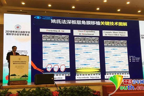 姚玉峰在2018年浙江省医学会眼科学分会学术年会上讲解姚氏法。资料图