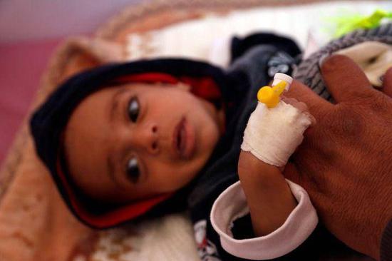 2019年11月13日，在也门萨那，感染疟疾的儿童在医院接受治疗