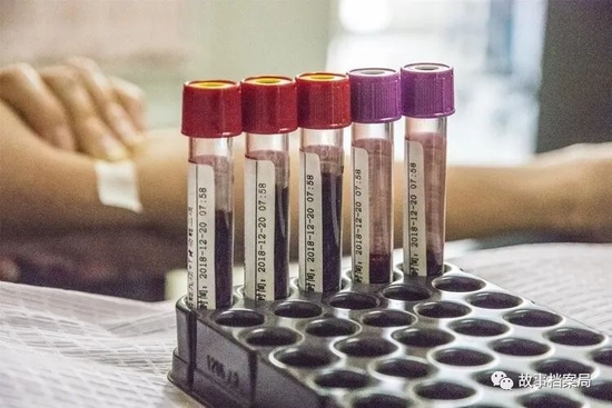 全世界最稀有的5大“黄金血型”,熊猫血未上榜,有的全球仅一例休闲区蓝鸢梦想 - Www.slyday.coM 全世界最稀有的5大“黄金血型”,熊猫血未上榜,有的全球仅一例休闲区蓝鸢梦想 - Www.slyday.coM