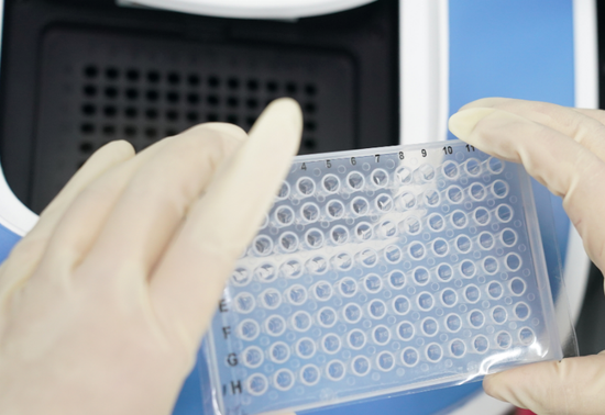 北京日报揭秘“病毒猎手”：面临气溶胶传染风险，做梦都在数数