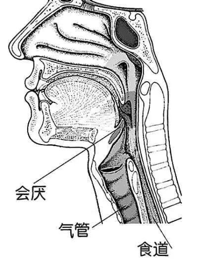 口咽通气管 结构图片