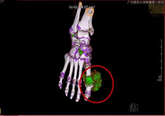 羊城晚报|广东男子穿人字拖爬雪山？这一“神操作”竟是因为……