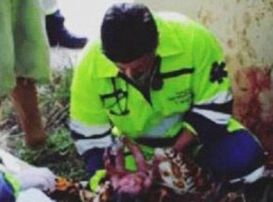 车祸孕妇:孕妇遇车祸肚子被划破 女婴遭挤出母体后生还