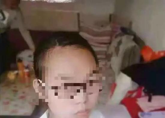 15岁少女被迫卖遭肢解案6名嫌疑人均未成年 张露生前的照片