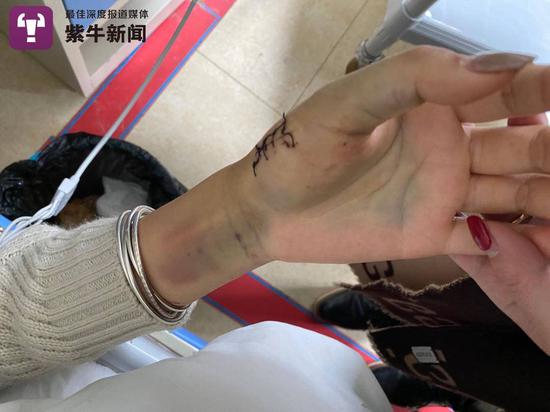 黄玉左手被魏某的刀所伤