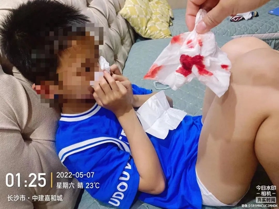 湖南长沙中建嘉和城小区，部分儿童出现不明原因鼻出血症状。