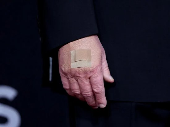 手上淤青真相来了？特朗普强调自己非常健康但后悔一件事