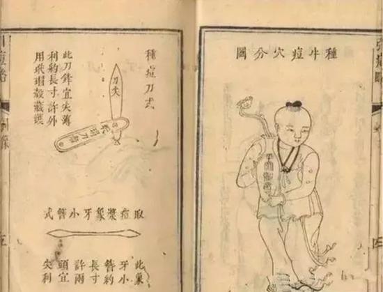 我国古代典籍记载的种痘法(资料图)