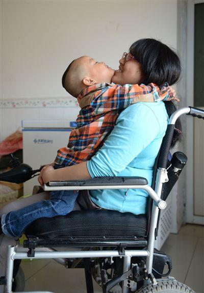 她汶川地震废墟中被挖出 3年17次截肢手术创纪录