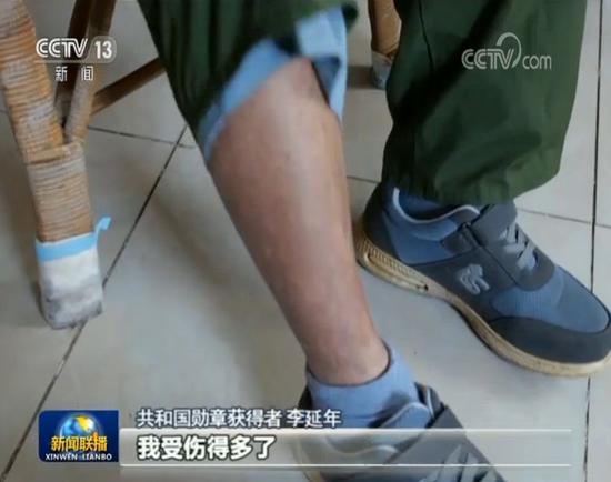 他站在这面墙前泪流满面:你们都不在了 我活下来了