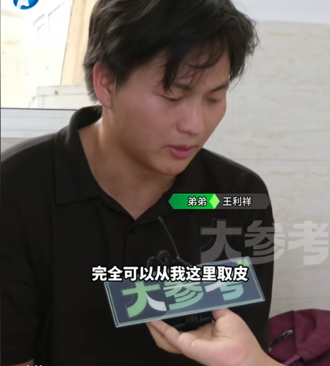 母亲突发意外全身85%重度烧伤，兄弟俩争相割皮救母，“父亲去世早，母亲打两三份工养大我们，刚有能力孝敬她却出了意外”
