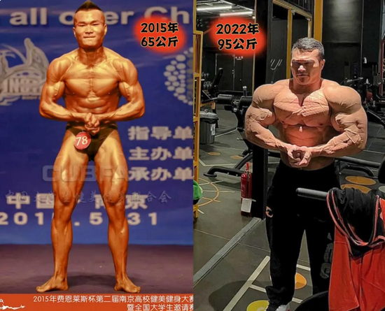 30岁健美冠军王昆死因披露！医生：这种急症，抢救成功率不足5%