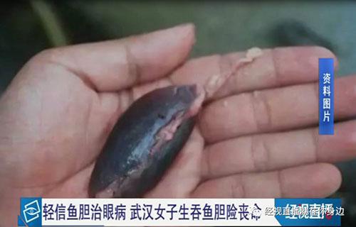 鱼胆明目?女子生吞鱼胆结果当晚肝衰竭住进医