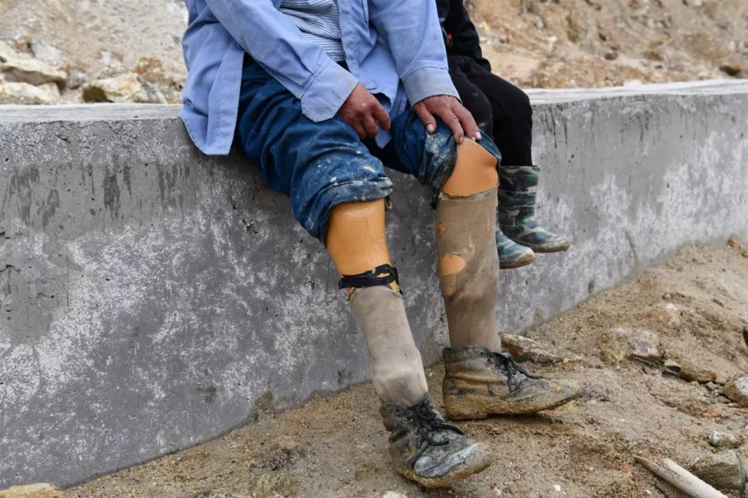 村民盘金良双腿被地雷炸伤而截肢。