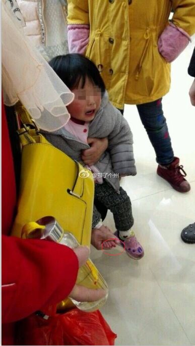 3岁女童脚趾被商场电梯咬住 母亲两秒将其拉出-图片1