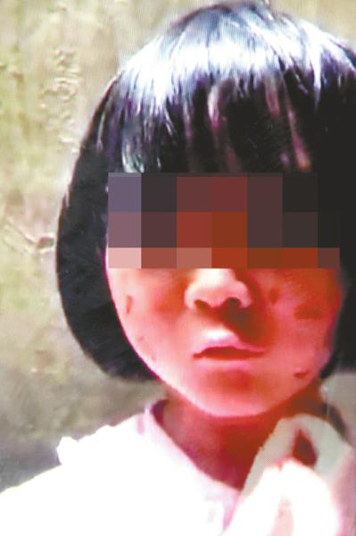6岁女童疑遭虐待 生父被人肉接数百个斥责电话