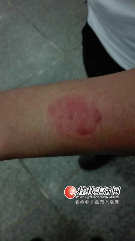 男子持剪刀在火车站伤人 咬伤民警扯烂其裤裆