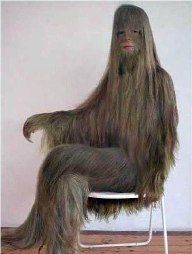 四乳女人 无眼女孩 多肢人 盘点人类怪胎