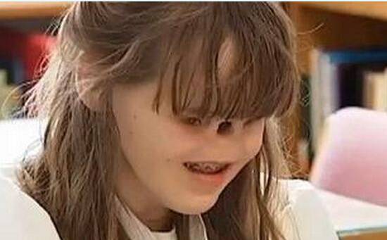 四乳女人 无眼女孩 多肢人 盘点人类怪胎