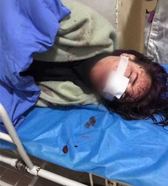 丽江被打女子:立案回执还没拿到 不知是否立案