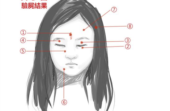 年仅六岁的韩宇馨头部中八