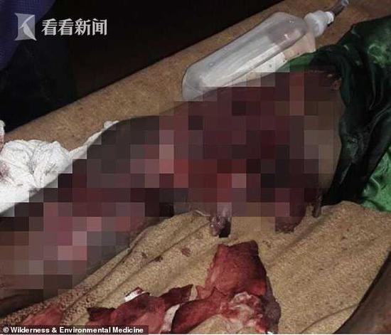 津巴布韦一男子遭鳄鱼袭击右腿 徒手掰嘴断指逃