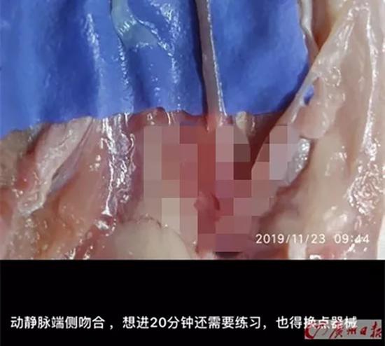 大叔每天买一个鸡鸭翅引猜想 真相原来是这个