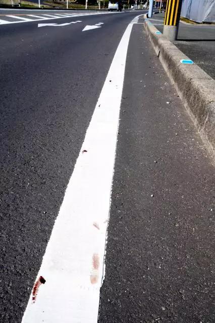 跪着爬完全程的饭田怜腿上留下的血迹。图片来源：日本《朝日新闻》