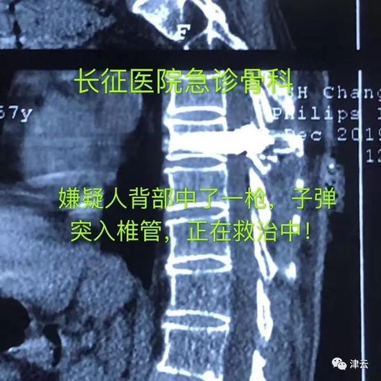  嫌疑人周某的受伤图片