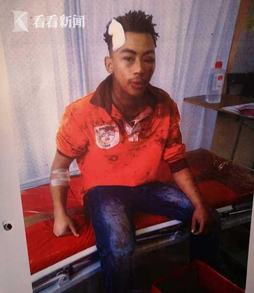 南非21岁女大遭轮后被砸死 4歹徒多次作案