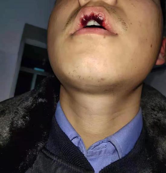 经现场了解,胡某(男,30岁,吉林四平人)大年初一随女友许某回沅江草尾