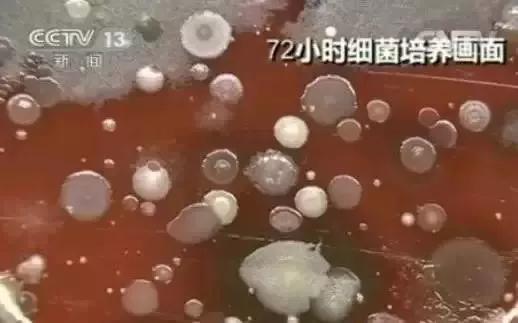 這東西比馬桶還臟 你卻天天抱著它吃飯
