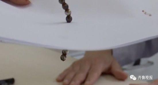 3岁男童肚子疼打针都无效 医生拍片发现异物(图